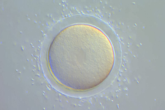La reproduction chez l'Oursin - Fécondation et développement - gryphea.com